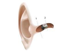 Hear Clearly Group